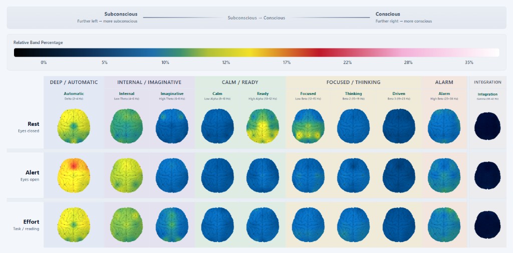 qEEG brain map: activity by frequency band across rest, alert, and effort states